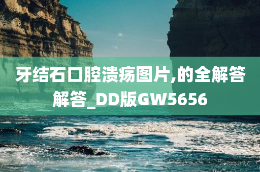 牙结石口腔溃疡图片,的全解答解答_DD版GW5656